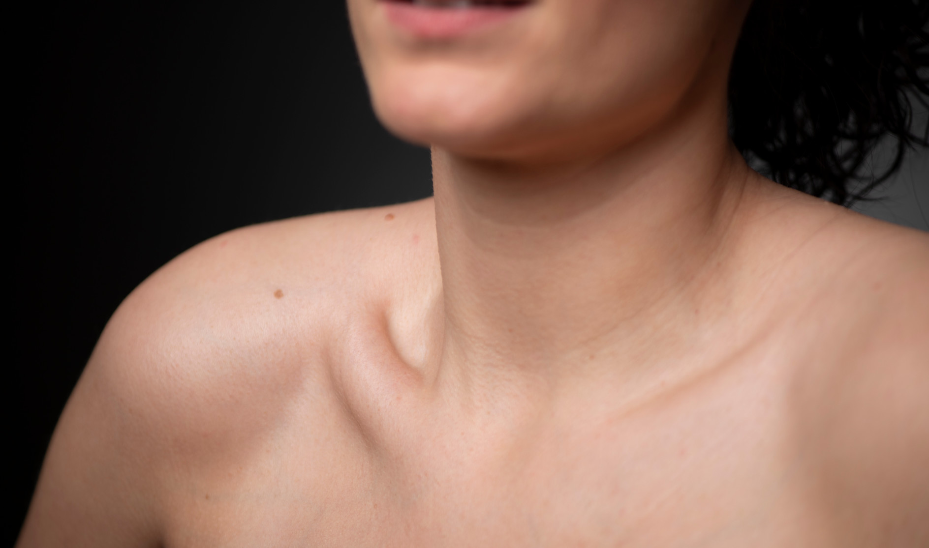 Banner image skin collarbone